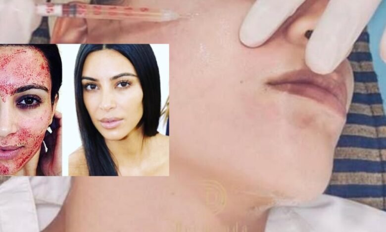 Dermand Clinic تقدم تقنية الـPRP بجودة عالية واهتمامٍ لا مثيل له