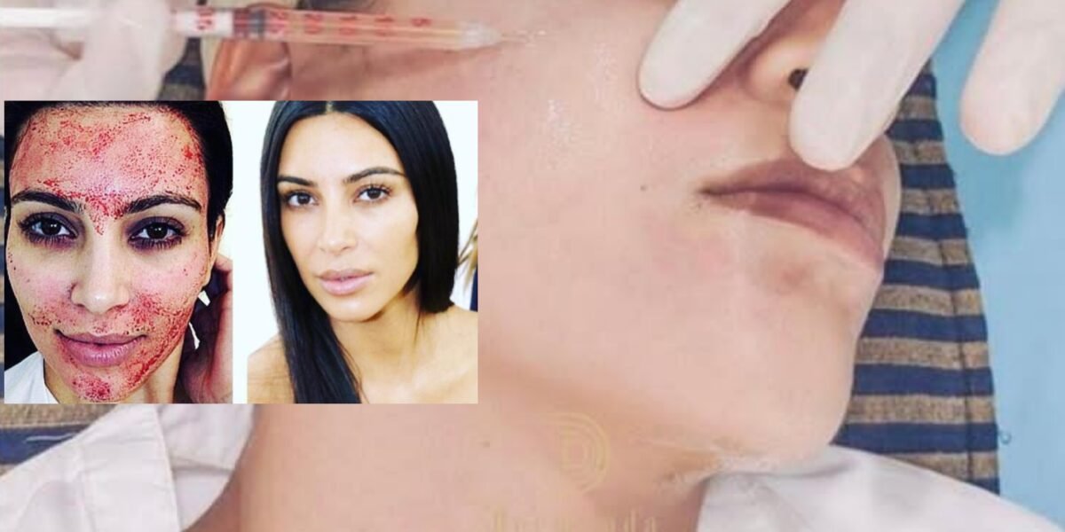 Dermand Clinic تقدم تقنية الـPRP بجودة عالية واهتمامٍ لا مثيل له - صورة مميزة صورة مميزة: Dermand Clinic تقدم تقنية الـPRP بجودة عالية واهتمامٍ لا مثيل له