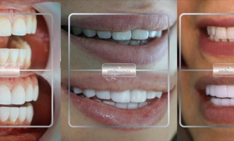 عيادة الدكتور حبيب ظريفه Ferrari Dental Clinic by Smile Infinity سبيلك الفريد للحصول على ابتسامة ساحرة