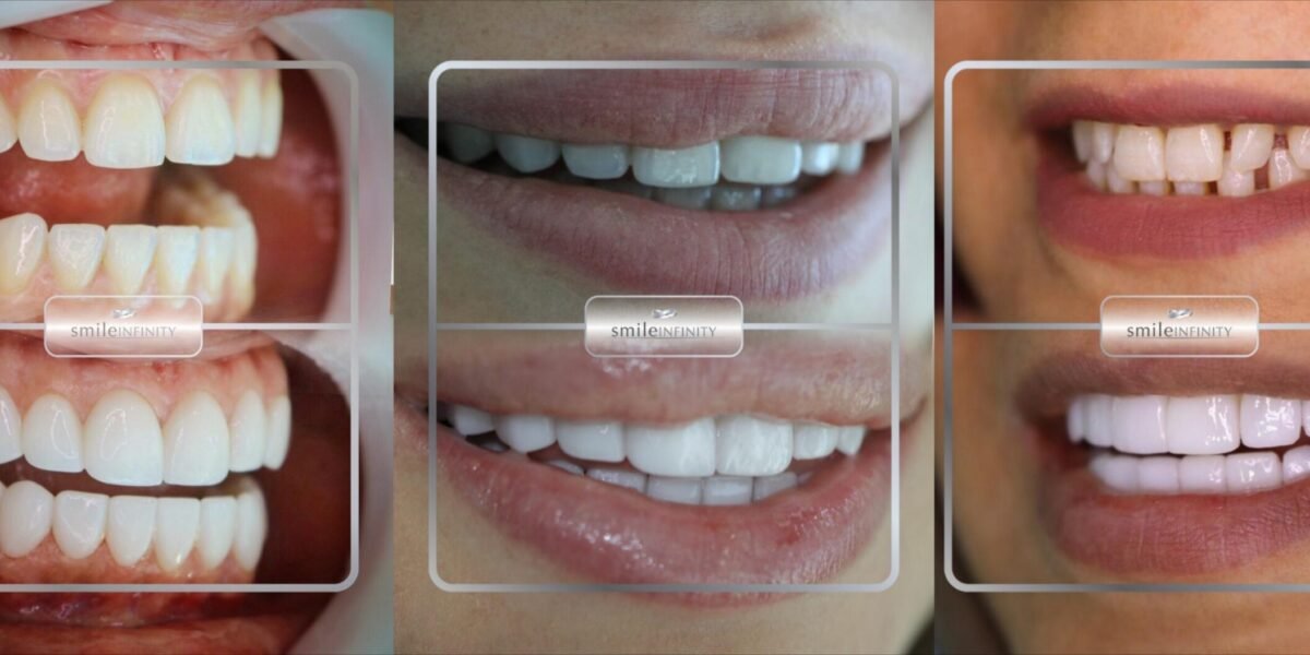 صورة مميزة: عيادة الدكتور حبيب ظريفه Ferrari Dental Clinic by Smile Infinity سبيلك الفريد للحصول على ابتسامة ساحرة